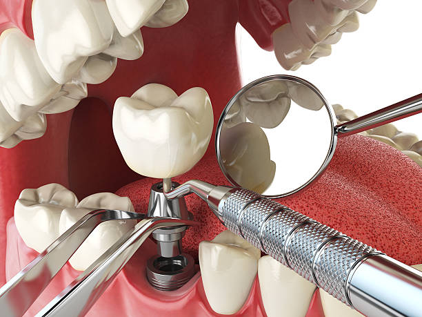 Best Emergency Care for Gum Disease in Hendersonville, NC